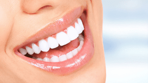 ranking najlepszych pasków wybielających do zębów